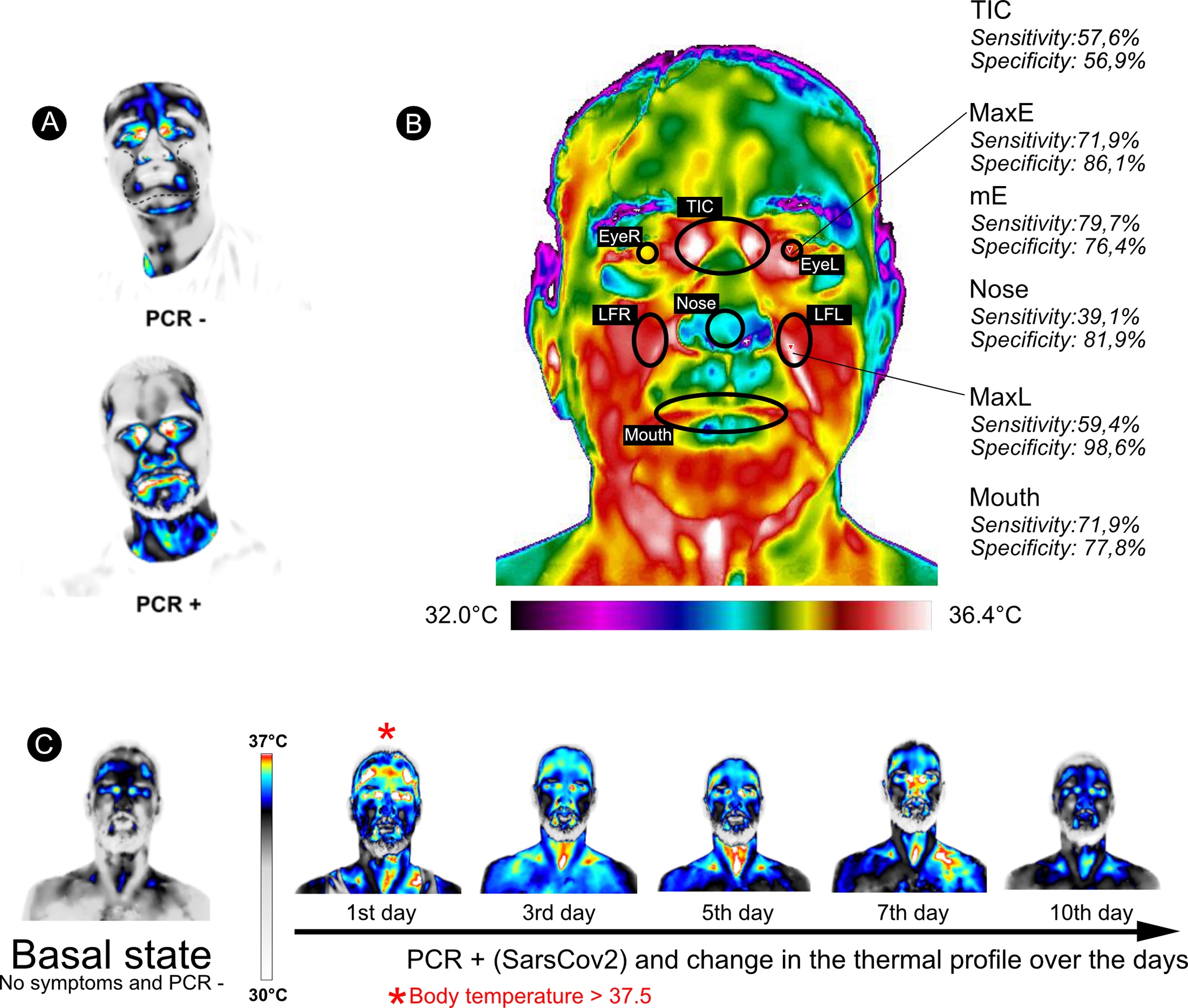 Figura científica con perfiles térmicos faciales, regiones de interés y evolución térmica de paciente evaluado en el estudio PLOS ONE.