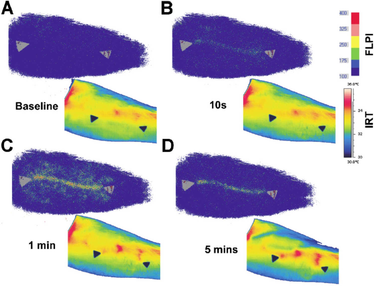 Comparación entre laser speckle contrast imaging y termografía después de estímulo mecánico en la piel del antebrazo