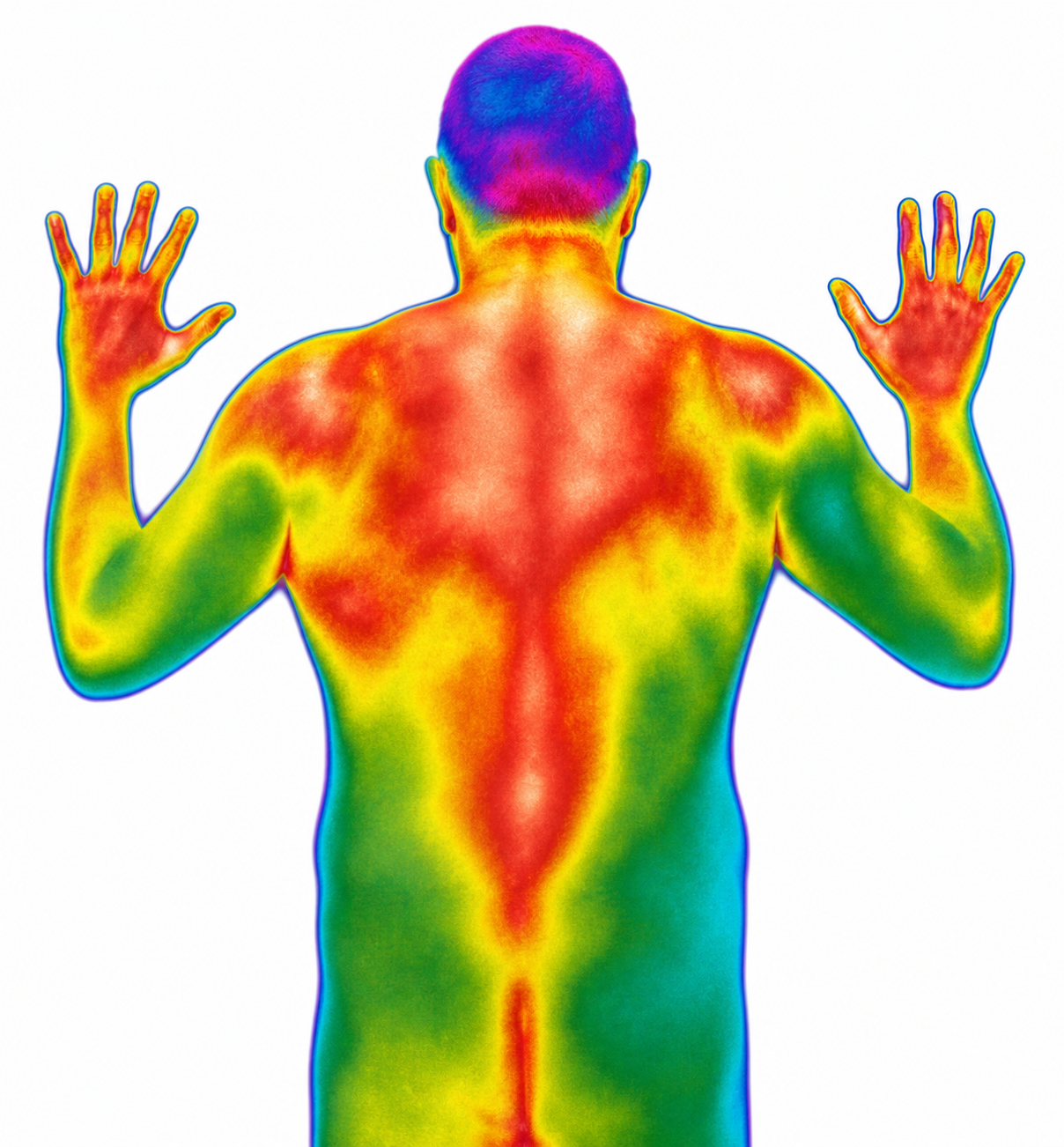Termograma do dorso — FLIR T430sc